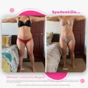 Drenaje Linfático Manual