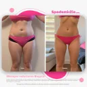 Masaje Reductor Intensivo